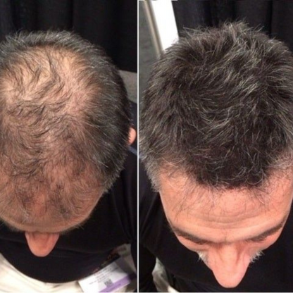 Fibras Capilares Toppik – Volumen instantáneo y natural