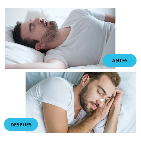 🌙 Bandas Nasales Magnéticas – Starter Kit